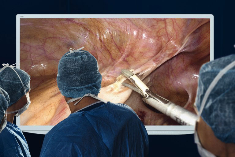 <center>Cirugía Mínima Invasión (Laparoscopia) y Endoscopia Urológica</center>